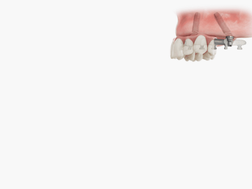 Implants course series