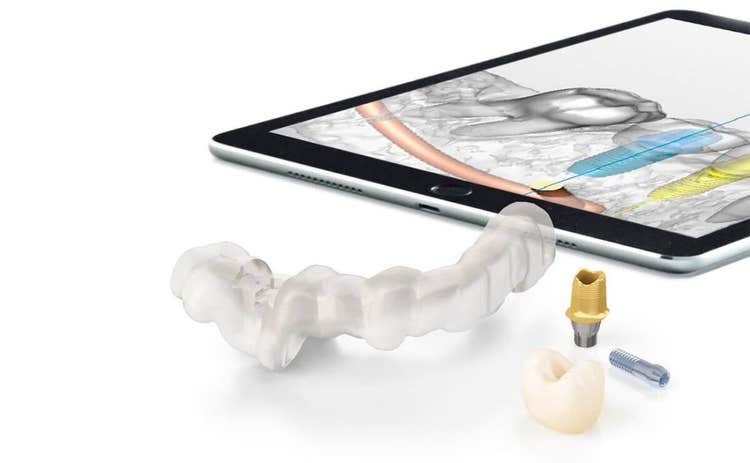 Digital implant workflow restoration kit