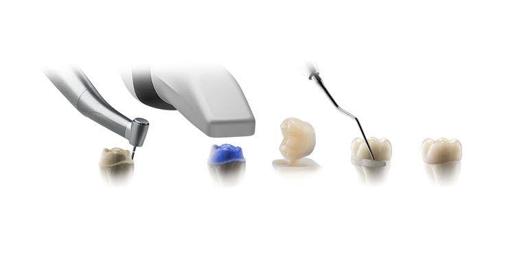 Instruments representing the digital chairside workflow for preparing, scanning, and restoring single-unit crowns.