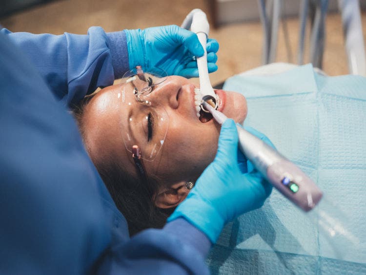 Dental polishing procedure to smooth tooth surfaces and support oral hygiene outcomes.