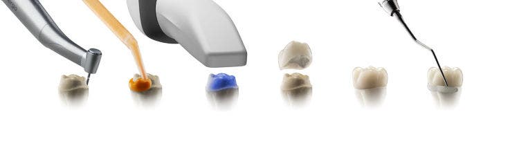Outils de flux de travail pour couronnes unitaires Dentsply Sirona, comprenant des fraises de préparation, des matériaux d'empreinte et des instruments accessoires.